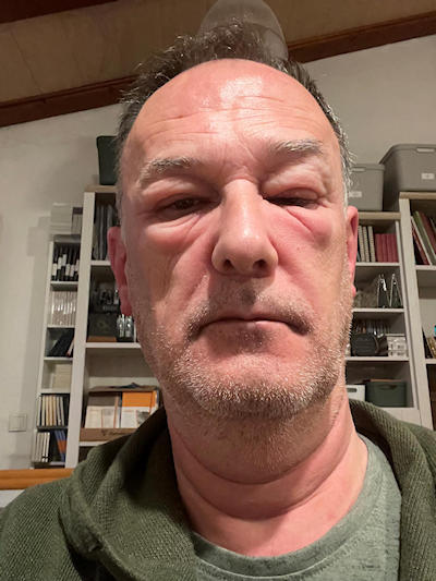 AllergieKlein.jpg